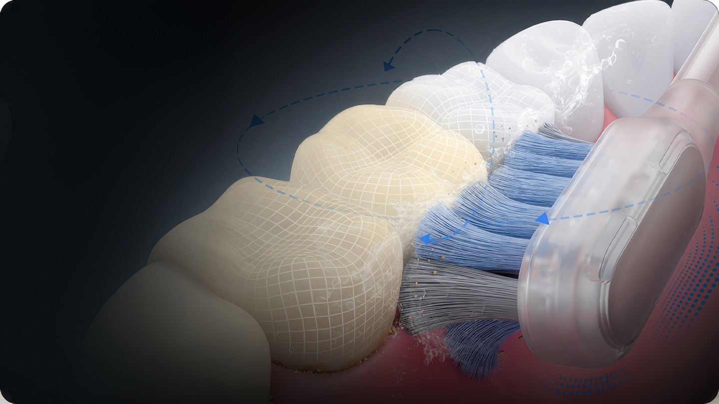 Технология 3DClean